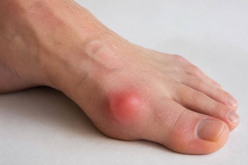découvrez les symptômes clés de la bursite au pied pour agir rapidement et prévenir l'installation de la douleur. informez-vous sur les signes d'alerte à ne pas manquer.